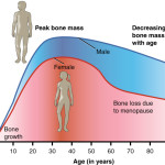 615_Age_and_Bone_Mass